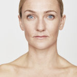 Botox Berlin » Effektiv & schonend | Beauty-Rebellin